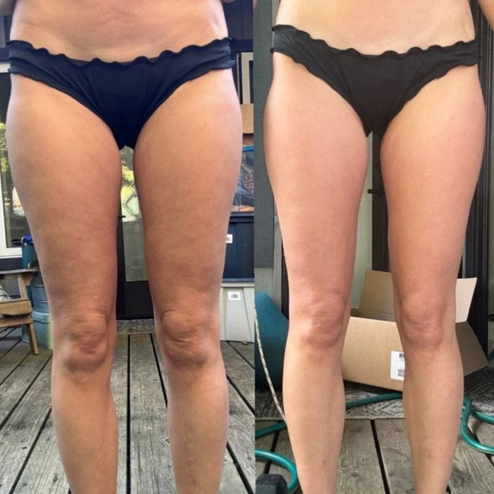 ContourEase™ Body Sculptor