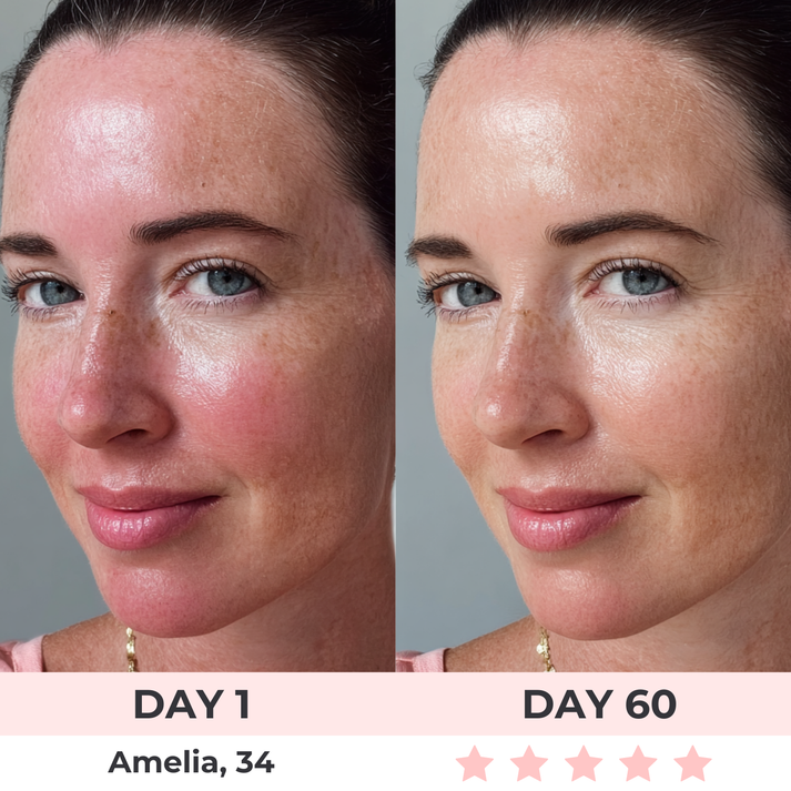 Balancezia™ - Red Light Therapy Mask